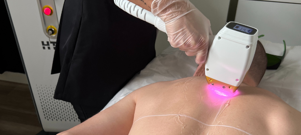 épilation définitive pour les hommes